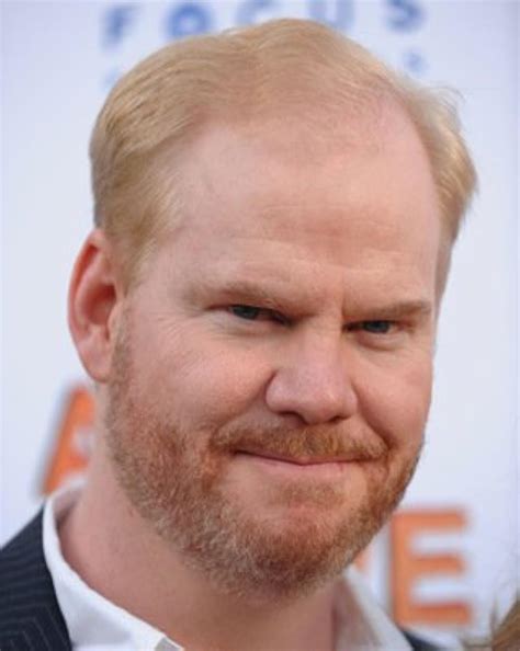 jim gaffigan hair transplant